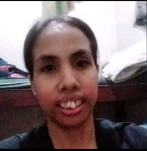 Susan
